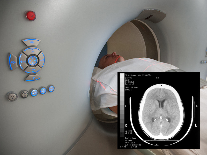 CT head scan / Image © ϲʿⱦ
